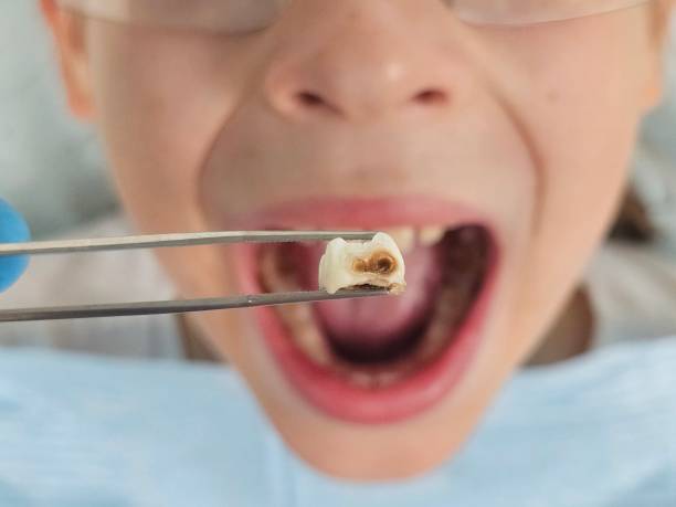 Best Emergency Pediatric Dental Care in Dalton Gardens, ID
